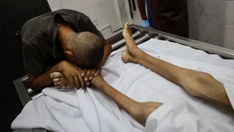 Gazze'de Acı Haber: Bir Çocuk Daha Açlıktan Hayata Veda Etti