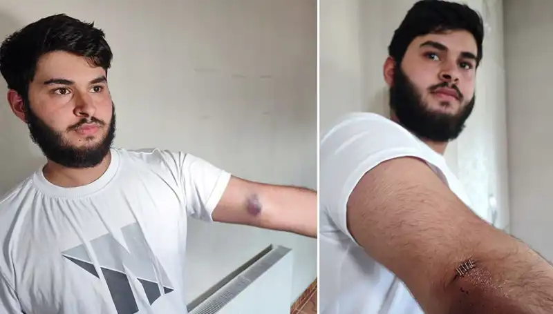 Bahçeye Kaçan Top, Mahallede Eğlenceli Bir Kaosa Yol Açtı