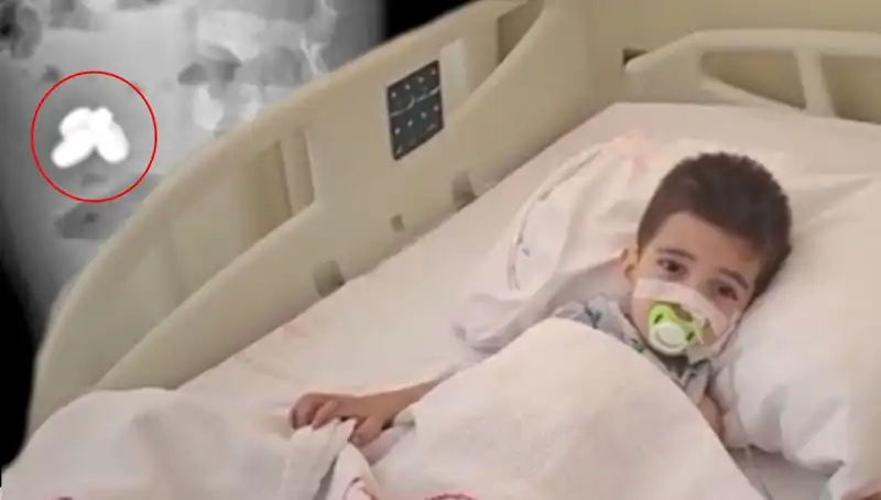 Pil ve Mıknatıs Yutan Çocuğun Bağırsağı Havaya Uçtu: Aile Şokta!